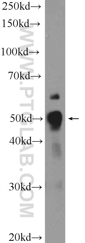 Western Blot (WB) analysis of A549 cells using BCL3 Polyclonal antibody (23959-1-AP)