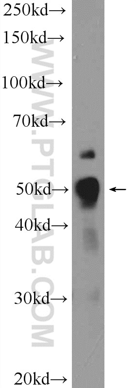 WB analysis of A549 using 23959-1-AP