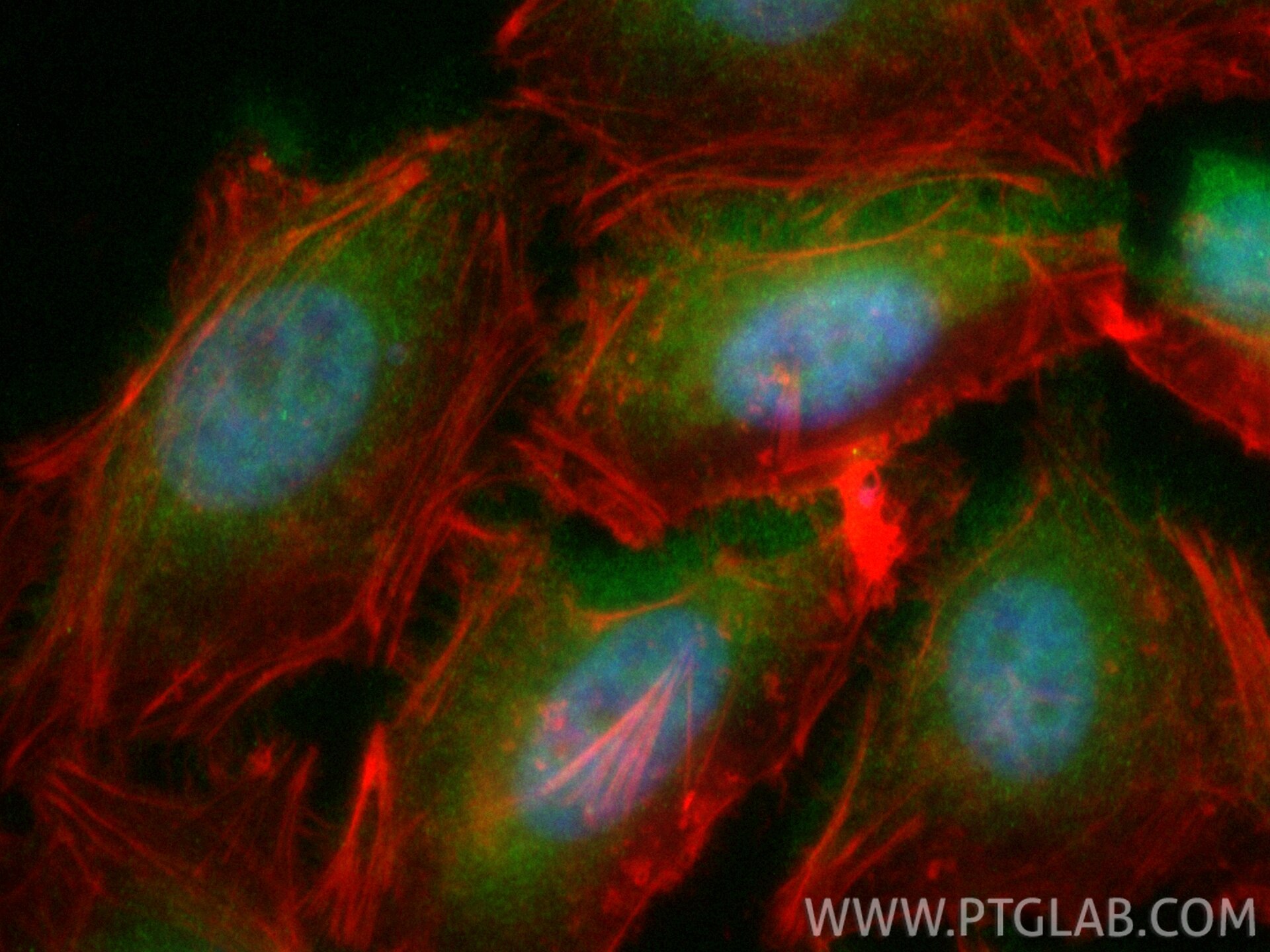 Immunofluorescence (IF) / fluorescent staining of HeLa cells using CoraLite® Plus 488-conjugated BCL3 Recombinant ant (CL488-84882-5)