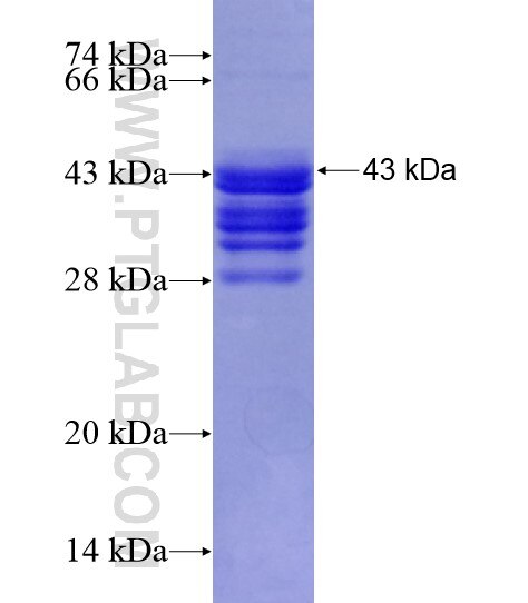 BCL3 fusion protein Ag21040 SDS-PAGE