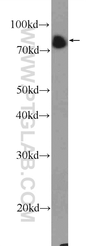 Western Blot (WB) analysis of Raji cells using BCL6 Polyclonal antibody (21187-1-AP)