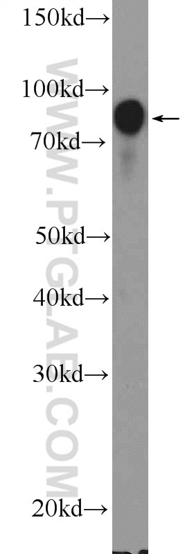 Western Blot (WB) analysis of Raji cells using BCL6 Polyclonal antibody (21187-1-AP)