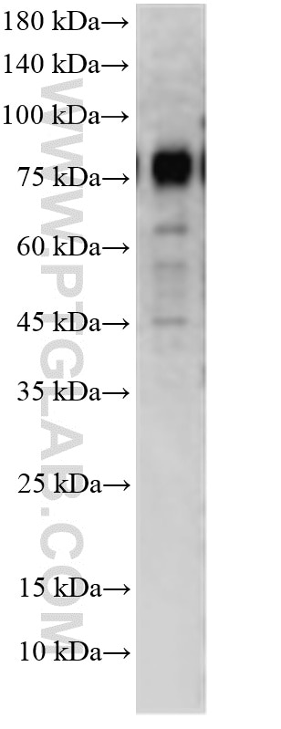 A20 cells were subjected to SDS PAGE followed by western blot with 21187-1-AP (BCL6 antibody) at dilution of 1:1000 incubated at room temperature for 1.5 hours. Western Blot (WB) analysis of A20 cells using BCL6 Polyclonal antibody (21187-1-AP)