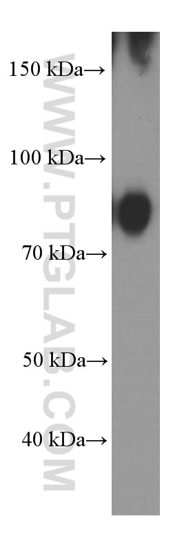 Western Blot (WB) analysis of Raji cells using BCL6 Monoclonal antibody (66340-1-Ig)