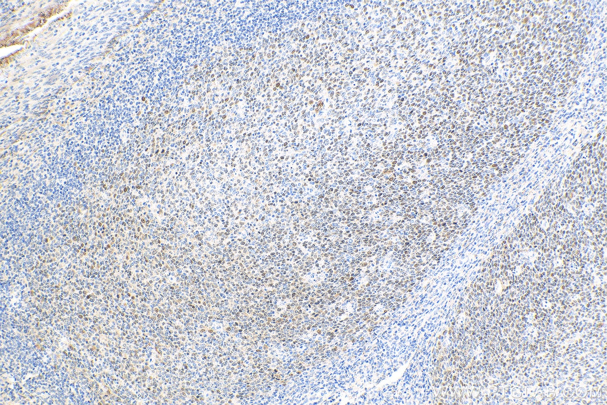 Immunohistochemistry (IHC) staining of human tonsillitis tissue using BCL6 Recombinant antibody (81754-1-RR)