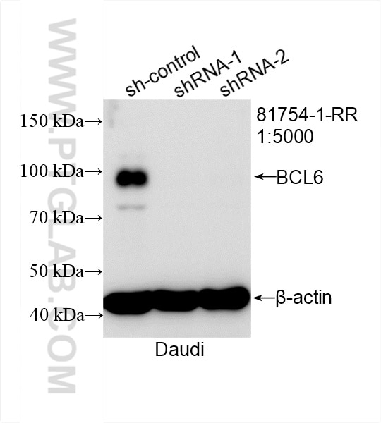Western Blot (WB) analysis of Daudi cells using BCL6 Recombinant antibody (81754-1-RR)