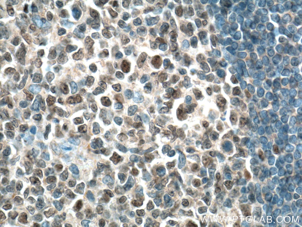 Immunohistochemistry (IHC) staining of human tonsillitis tissue using Biotin-conjugated BCL6 Monoclonal antibody (Biotin-66340)