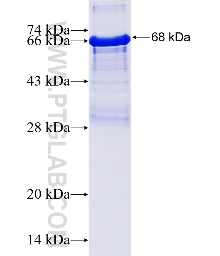 BCL6 fusion protein Ag15519 SDS-PAGE