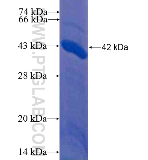 BCL7A fusion protein Ag12730 SDS-PAGE