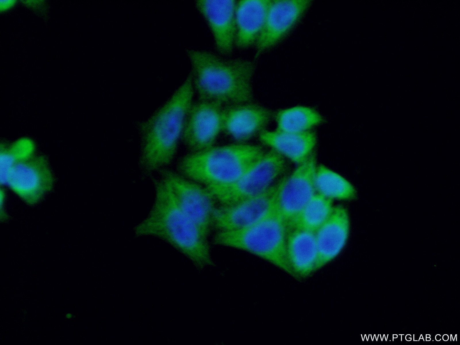 Immunofluorescence (IF) / fluorescent staining of HeLa cells using BCL7B Polyclonal antibody (11740-1-AP)