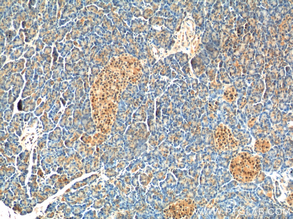 Immunohistochemistry (IHC) staining of human pancreas tissue using BCL7B Polyclonal antibody (11740-1-AP)