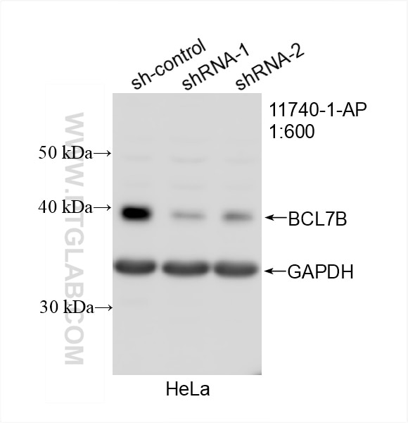Western Blot (WB) analysis of HeLa cells using BCL7B Polyclonal antibody (11740-1-AP)
