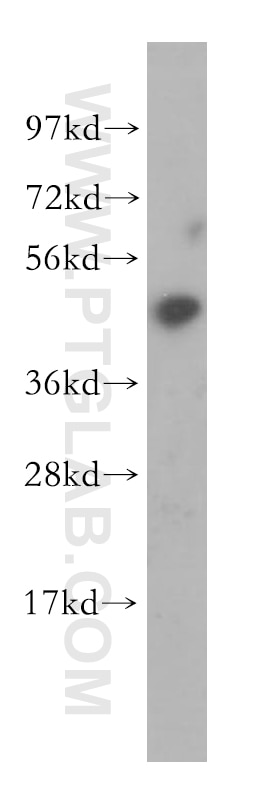 Western Blot (WB) analysis of HeLa cells using BCL7B Polyclonal antibody (11740-1-AP)