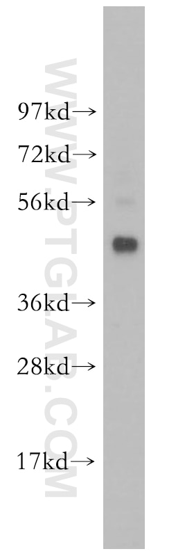 Western Blot (WB) analysis of human brain tissue using BCL7B Polyclonal antibody (11740-1-AP)