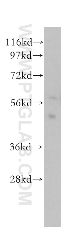 Western Blot (WB) analysis of human lung tissue using BCL7C Polyclonal antibody (11455-1-AP)