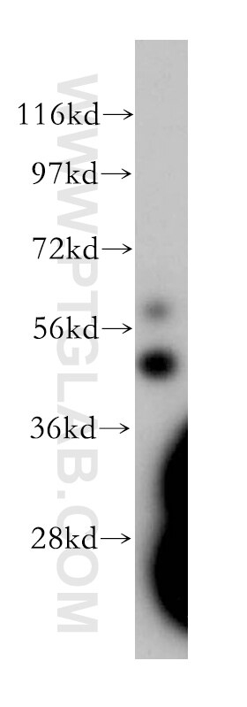 Western Blot (WB) analysis of human brain tissue using BCL7C Polyclonal antibody (11455-1-AP)