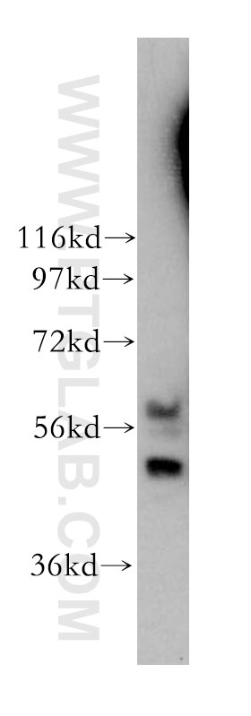 Western Blot (WB) analysis of Jurkat cells using BCL7C Polyclonal antibody (11455-1-AP)