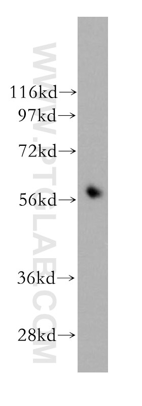Western Blot (WB) analysis of human spleen tissue using BCL7C Polyclonal antibody (11455-1-AP)