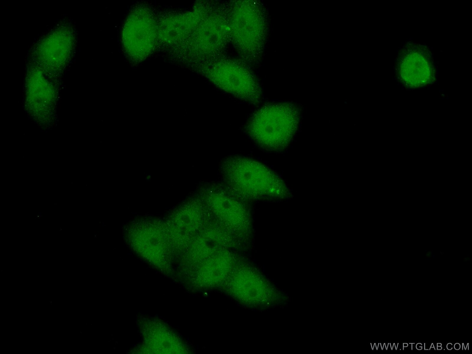 Immunofluorescence (IF) / fluorescent staining of HeLa cells using BCL9 Polyclonal antibody (22947-1-AP)