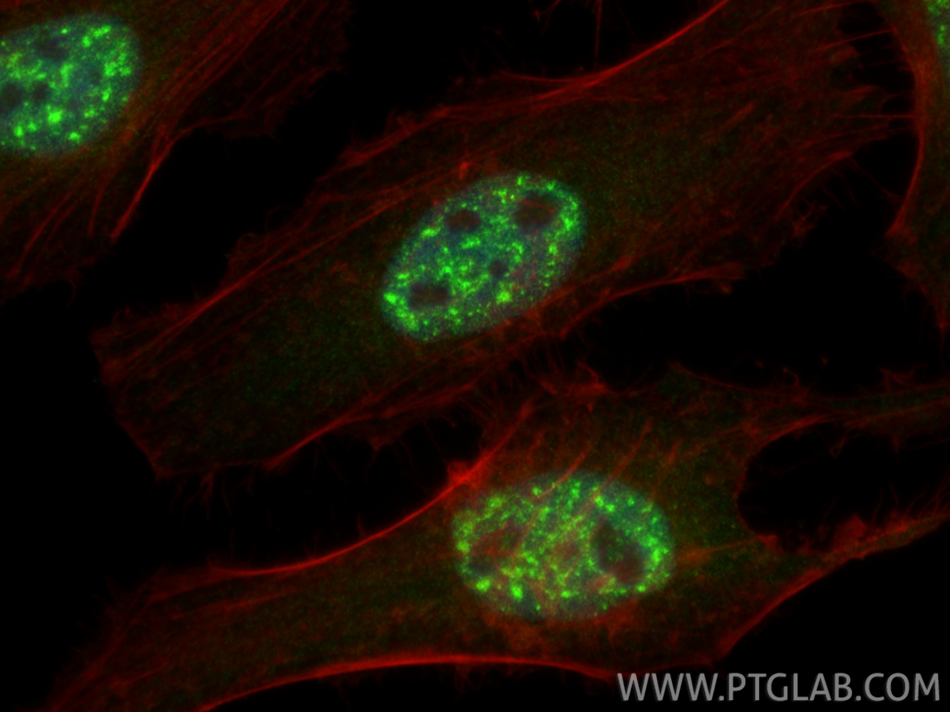 Immunofluorescence (IF) / fluorescent staining of HeLa cells using BCL9 Polyclonal antibody (22947-1-AP)
