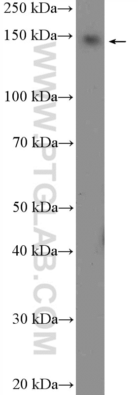 Western Blot (WB) analysis of Jurkat cells using BCL9 Polyclonal antibody (22947-1-AP)