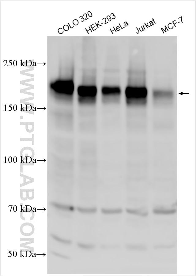 Western Blot (WB) analysis of various lysates using BCL9 Polyclonal antibody (22947-1-AP)