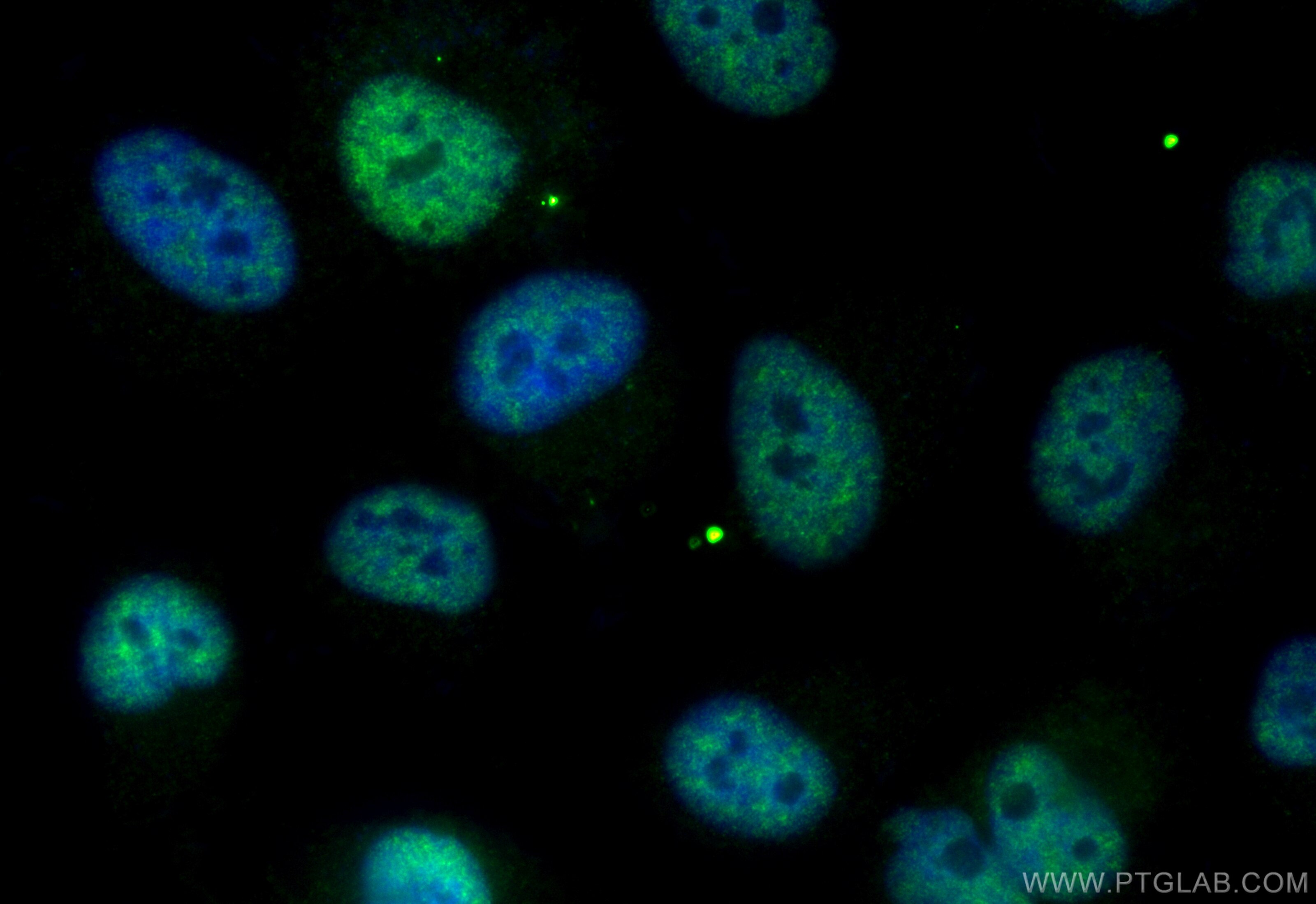 Immunofluorescence (IF) / fluorescent staining of HeLa cells using CoraLite® Plus 488-conjugated BCL9 Recombinant ant (CL488-83760-3)