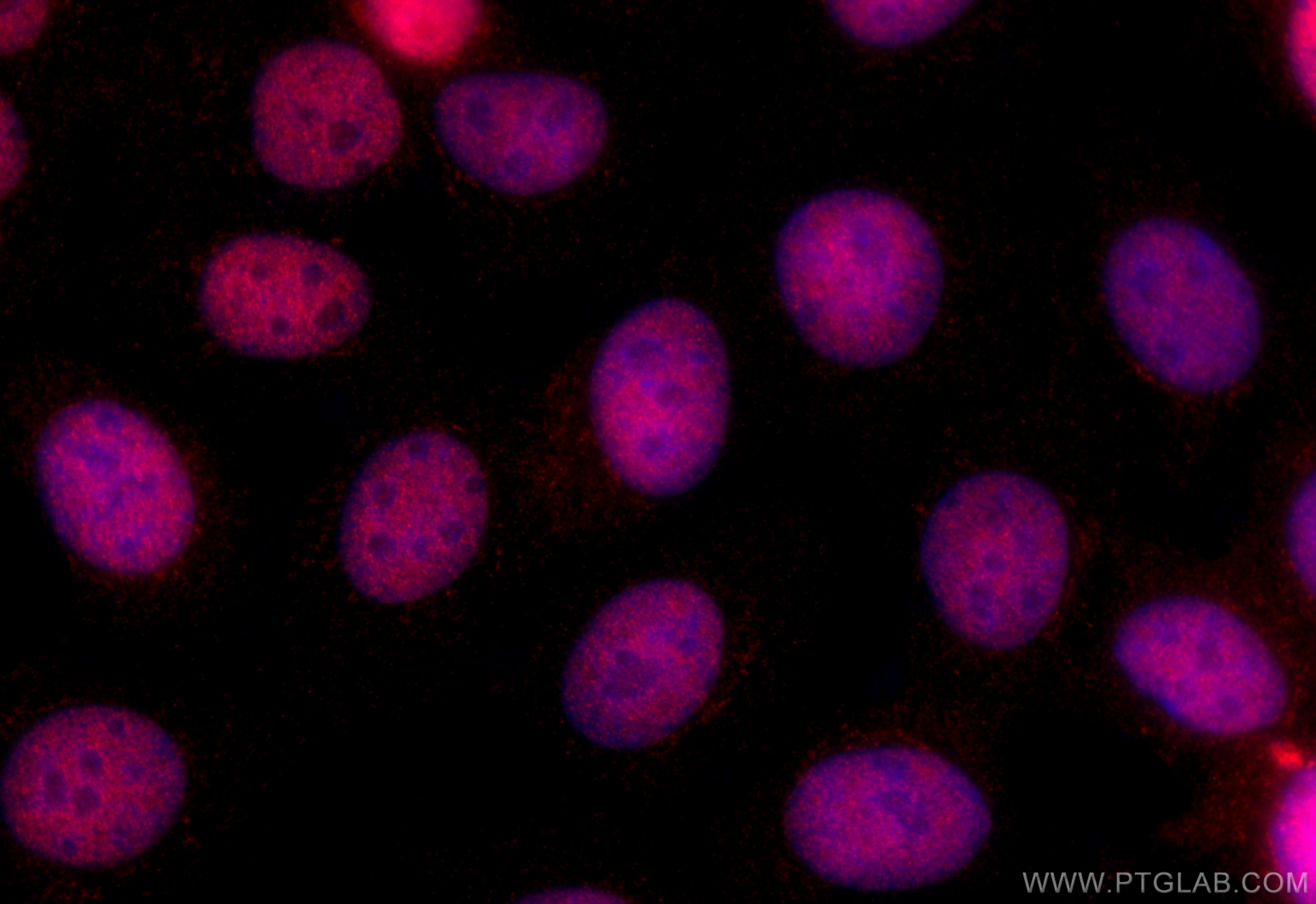 Immunofluorescence (IF) / fluorescent staining of MCF-7 cells using BCL9L Polyclonal antibody (32103-1-AP)