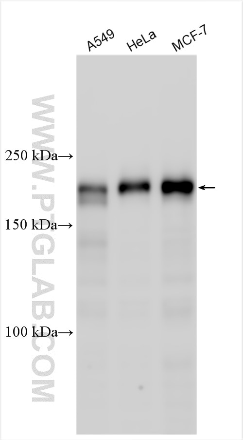 Western Blot (WB) analysis of various lysates using BCL9L Polyclonal antibody (32103-1-AP)