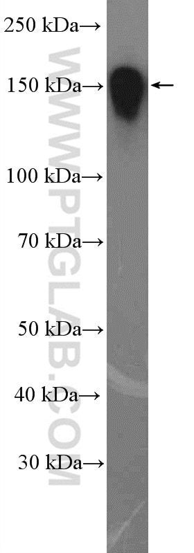 Western Blot (WB) analysis of MCF-7 cells using BCLAF1 Polyclonal antibody (26809-1-AP)