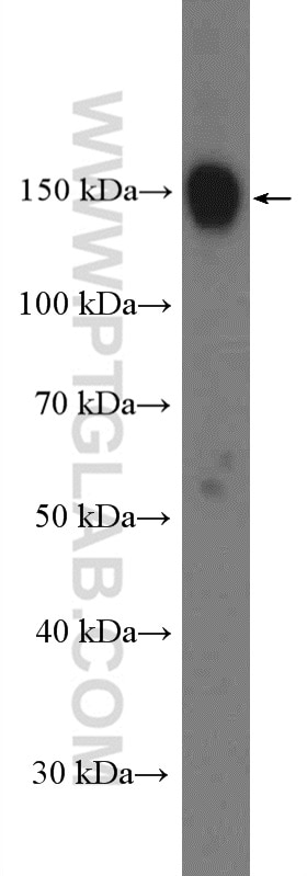 Western Blot (WB) analysis of Jurkat cells using BCLAF1 Polyclonal antibody (26809-1-AP)