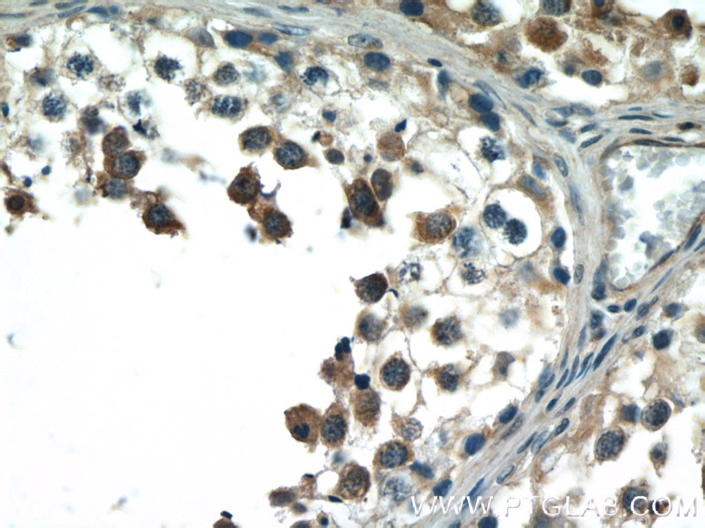 Immunohistochemistry (IHC) staining of human testis tissue using BCMO1 Polyclonal antibody (23308-1-AP)