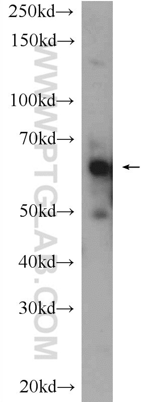Western Blot (WB) analysis of mouse colon tissue using BCMO1 Polyclonal antibody (23308-1-AP)