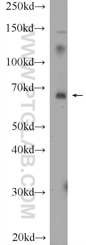 Western Blot (WB) analysis of COLO 320 cells using BCMO1 Polyclonal antibody (23308-1-AP)