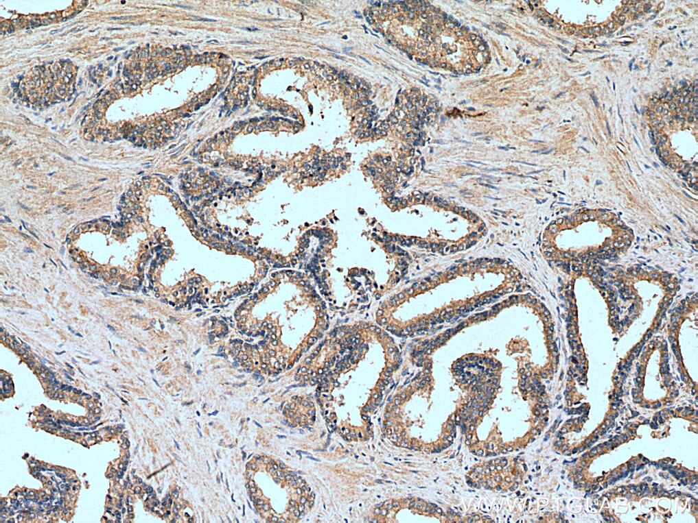 Immunohistochemistry (IHC) staining of human prostate hyperplasia tissue using BCO2 Polyclonal antibody (14324-1-AP)