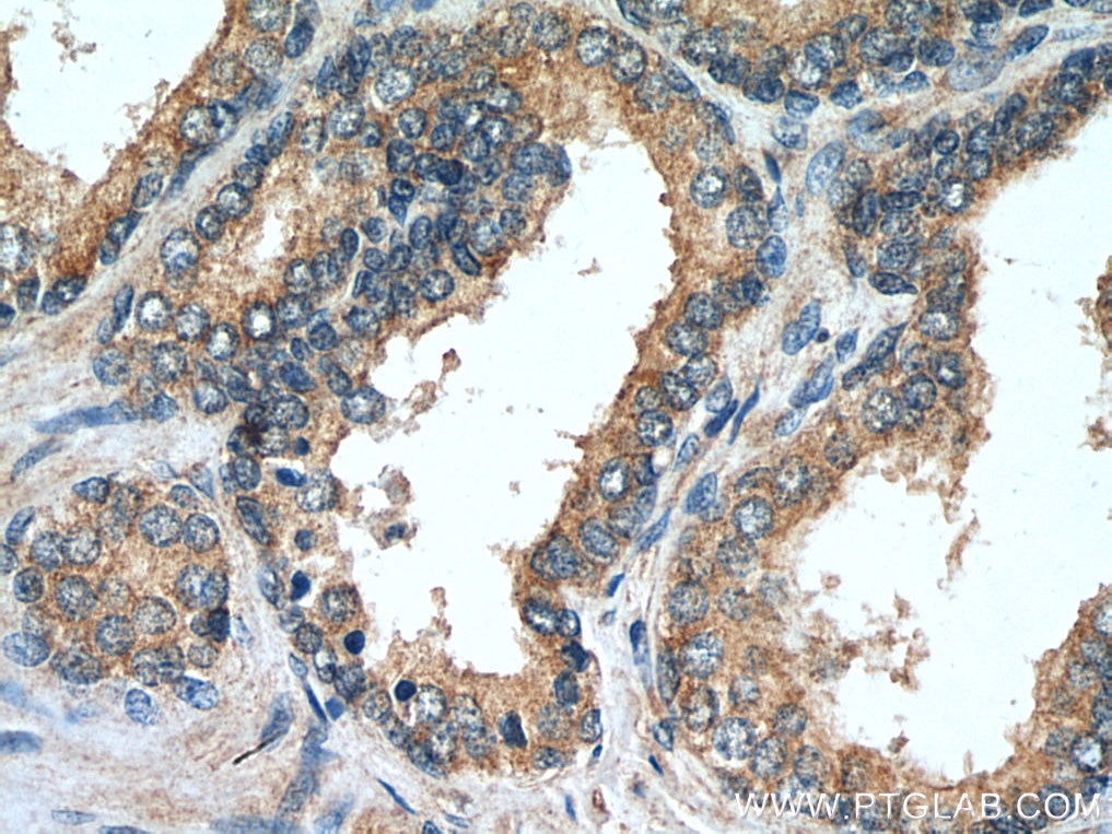 Immunohistochemistry (IHC) staining of human prostate hyperplasia tissue using BCO2 Polyclonal antibody (14324-1-AP)