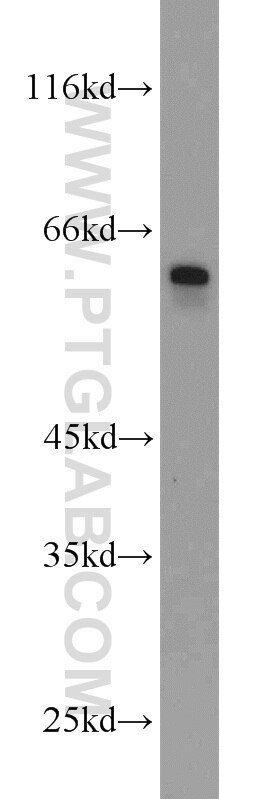 Western Blot (WB) analysis of L02 cells using BCO2 Polyclonal antibody (14324-1-AP)