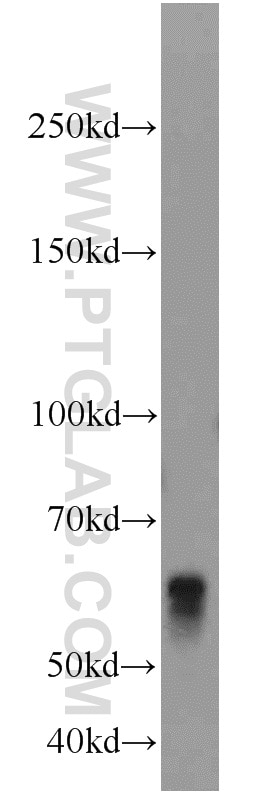 Western Blot (WB) analysis of mouse liver tissue using BCO2 Polyclonal antibody (14324-1-AP)