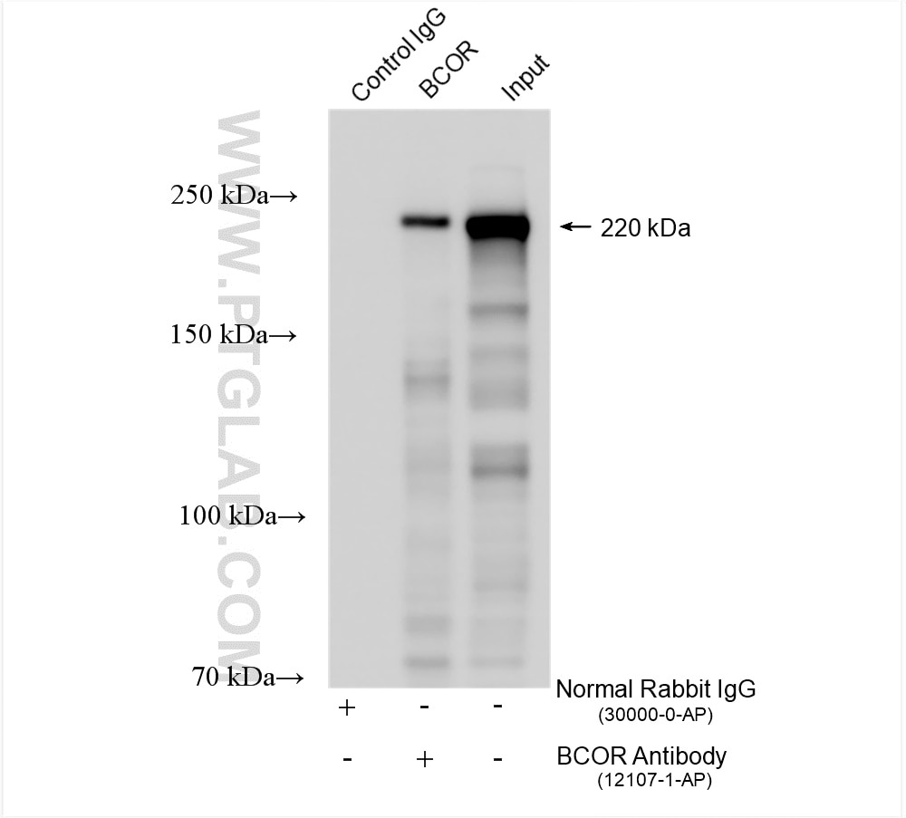 Immunoprecipitation (IP) experiment of HEK-293 cells using BCOR Polyclonal antibody (12107-1-AP)