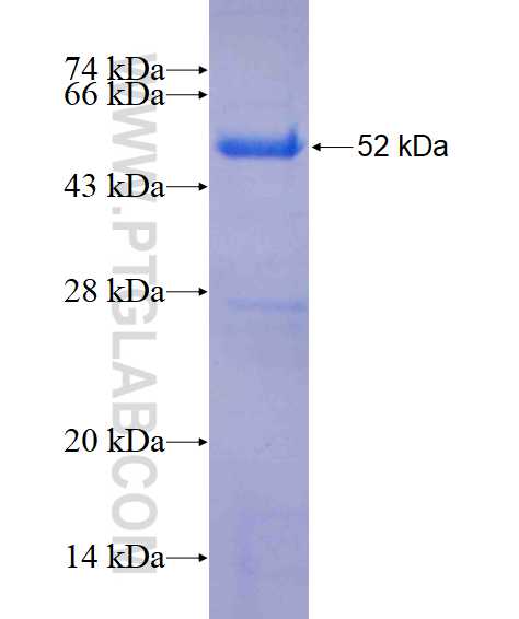 BCOR fusion protein Ag25245 SDS-PAGE