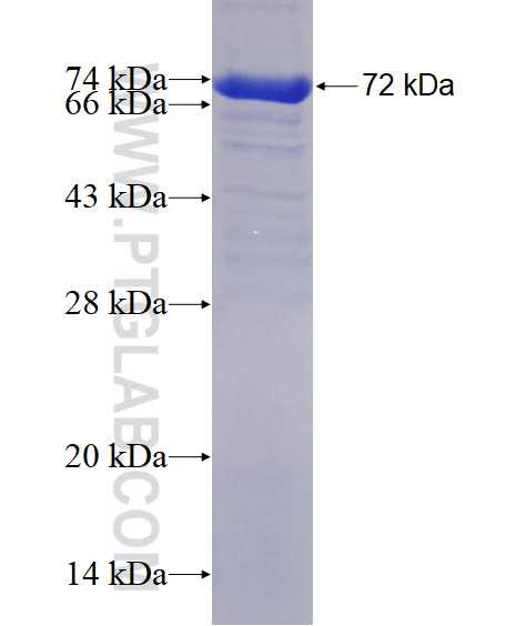 BCOR fusion protein Ag2752 SDS-PAGE