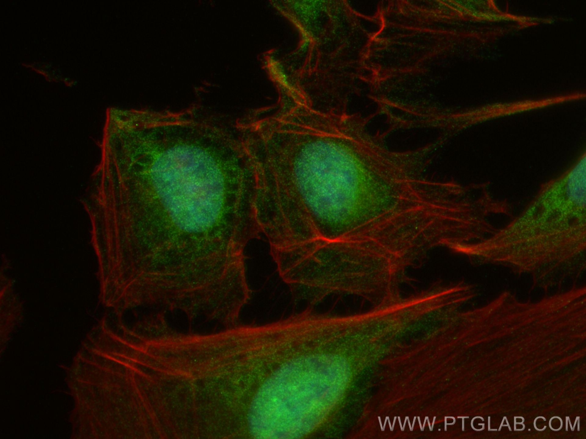Immunofluorescence (IF) / fluorescent staining of U2OS cells using BCORL1 Polyclonal antibody (24315-1-AP)