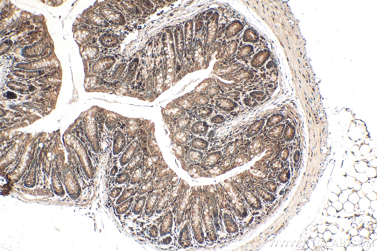 Immunohistochemistry (IHC) staining of mouse colon tissue using BCORL1 Polyclonal antibody (24315-1-AP)