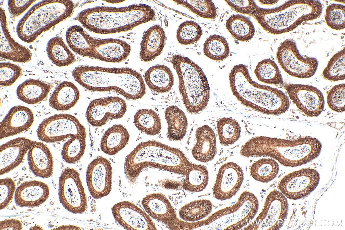 Immunohistochemistry (IHC) staining of mouse testis tissue using BCORL1 Polyclonal antibody (24315-1-AP)