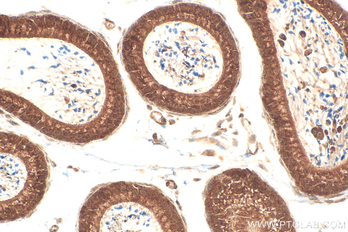 Immunohistochemistry (IHC) staining of mouse testis tissue using BCORL1 Polyclonal antibody (24315-1-AP)