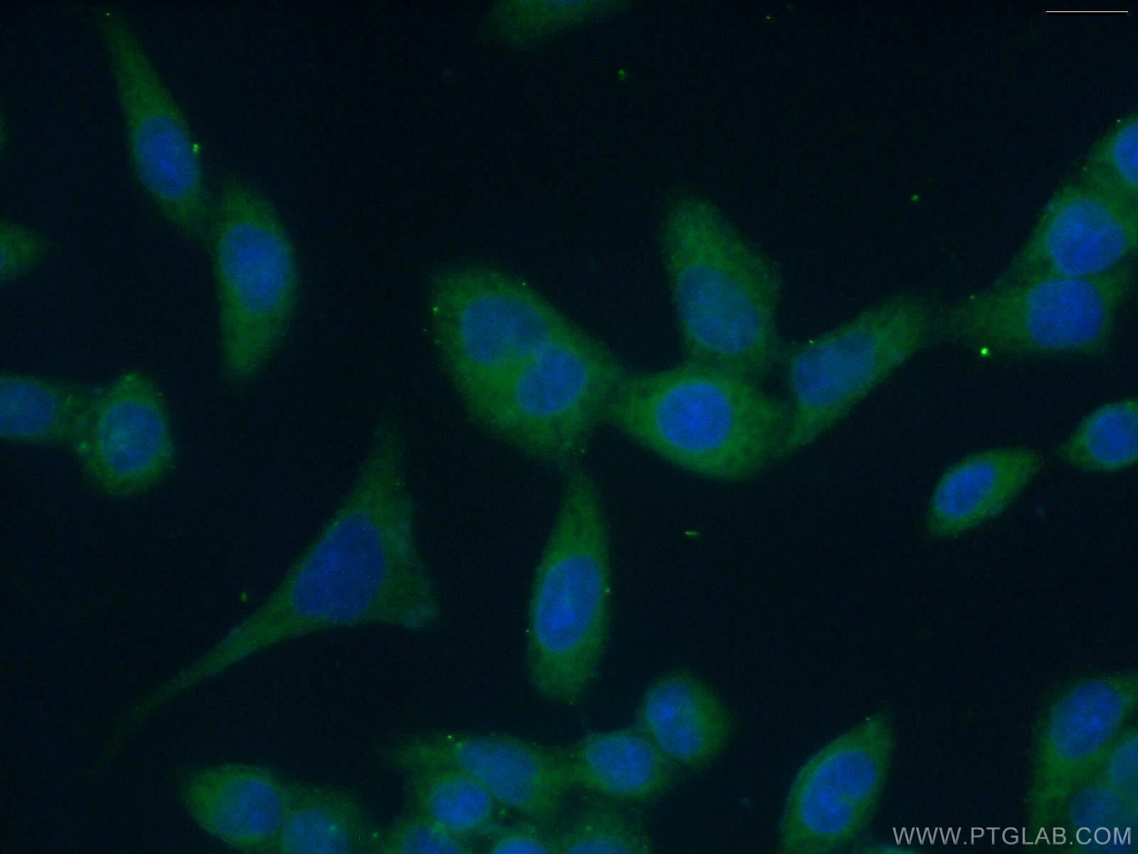 Immunofluorescence (IF) / fluorescent staining of HeLa cells using BCR Polyclonal antibody (22585-1-AP)
