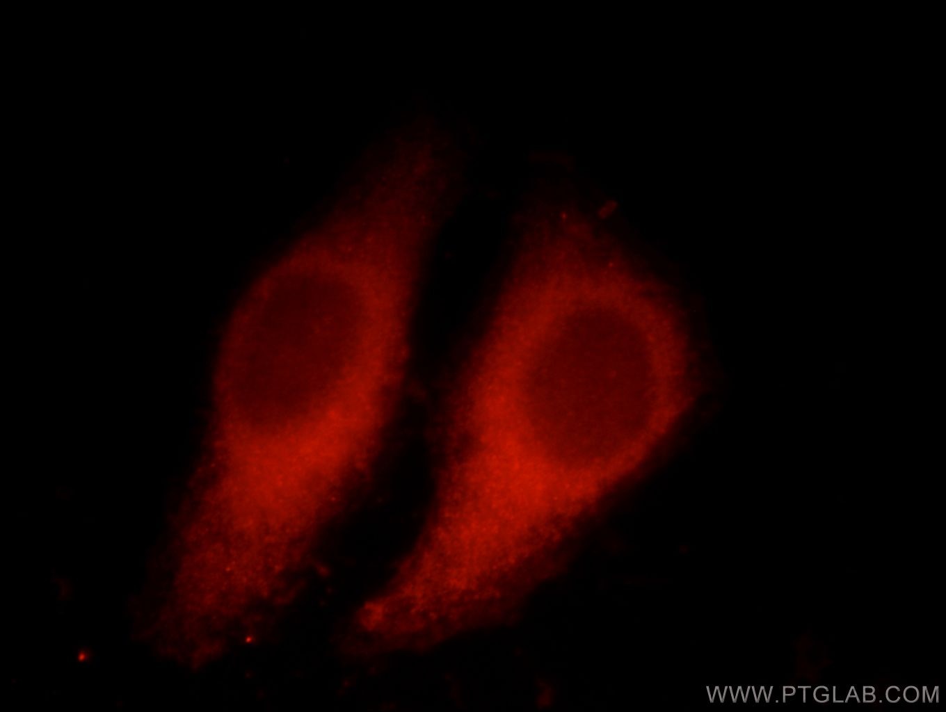 Immunofluorescence (IF) / fluorescent staining of HepG2 cells using BCR Polyclonal antibody (22585-1-AP)