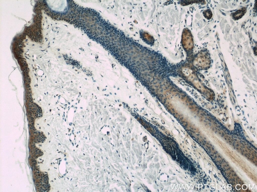 Immunohistochemistry (IHC) staining of human skin tissue using BCR Polyclonal antibody (22585-1-AP)