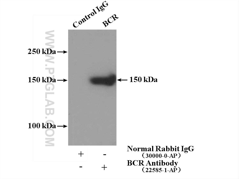 IP experiment of HEK-293 using 22585-1-AP