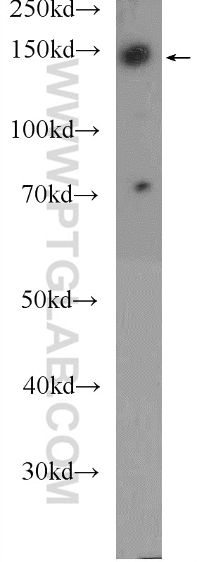 Western Blot (WB) analysis of HeLa cells using BCR Polyclonal antibody (22585-1-AP)